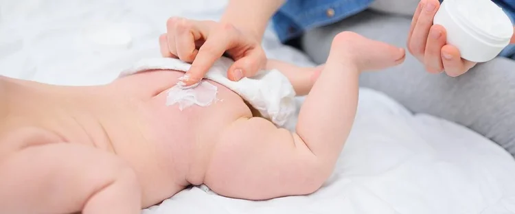 How To Prevent Diaper Rash Babies