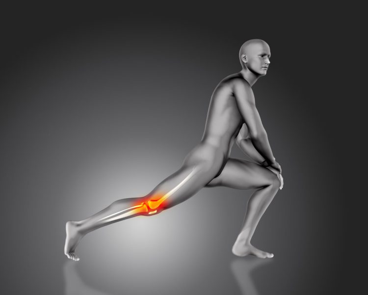 پماد موضعی لیدوکائین اچ ابوریحان