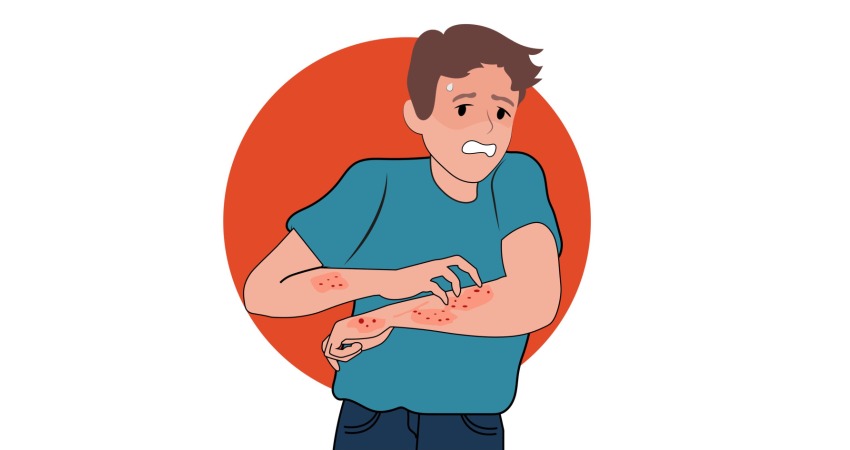 نقش بیوفلاوئید در کاهش علائم آلرژی