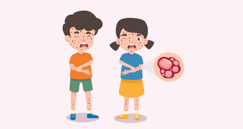 آنتی بیوتیک قوی برای عفونت پوستی