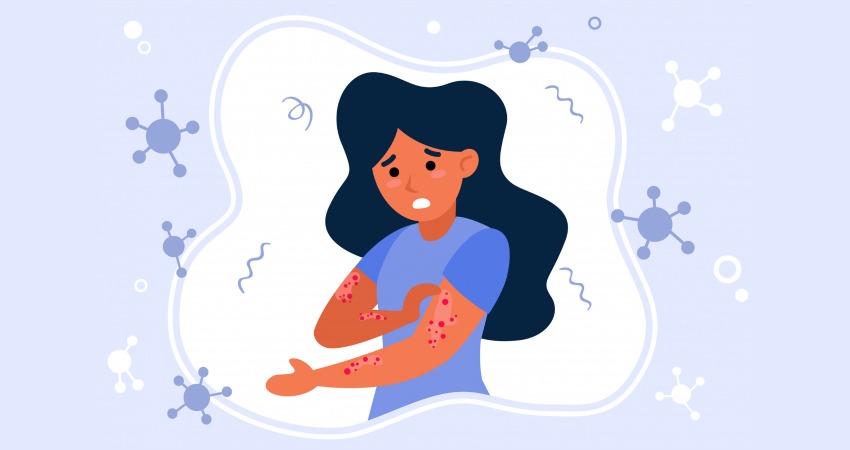 همه چیز درباره عفونت پوستی