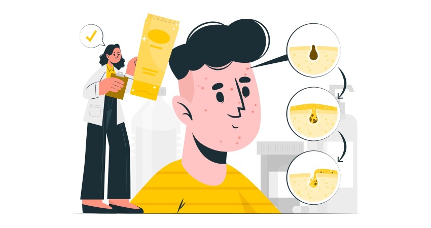 نحوه مصرف کلیندامایسین برای جوش