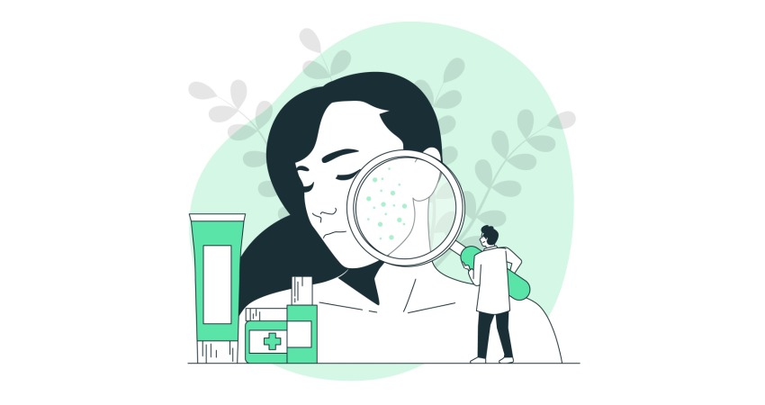 سالیسیلیک اسید برای جوش