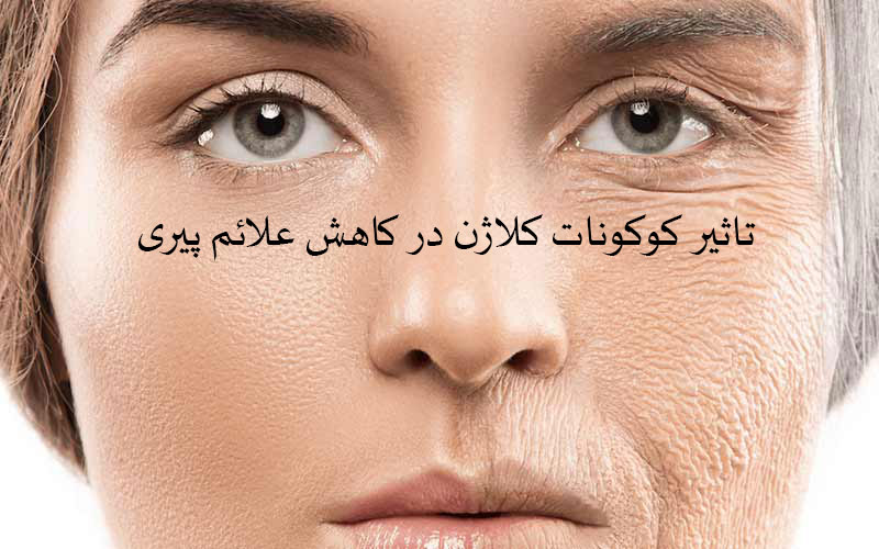 کاهش علائم پیری با کپسول کوکونات کلاژن