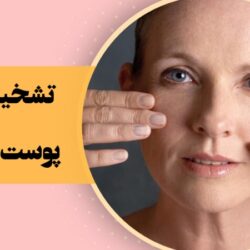 تشخیص نوع پوست در خانه