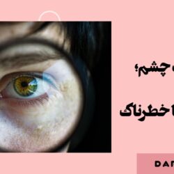 مشکلات چشم را جدی بگیرید