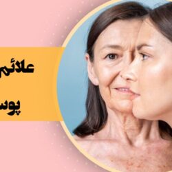 علائم پیری پوست